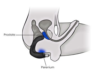 Prostata Stimulering